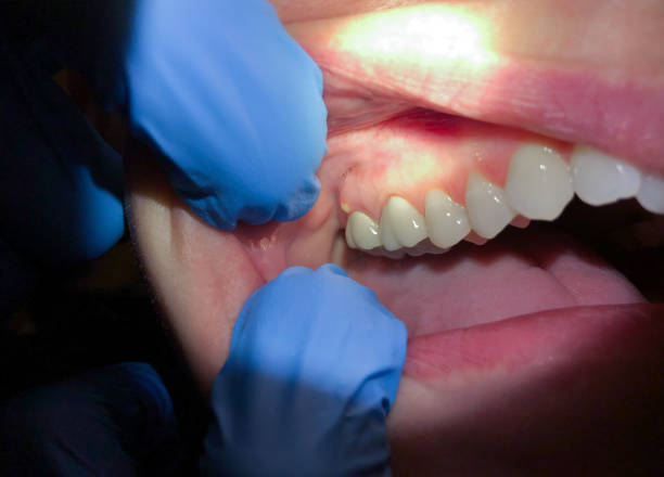 Best Emergency Broken Tooth Repair in Badger, AK